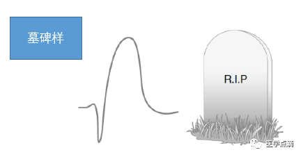 心电图总是记不住？这些基础知识一定要掌握！