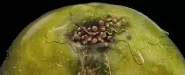 提醒！根管治疗成功，一定要注意这5点