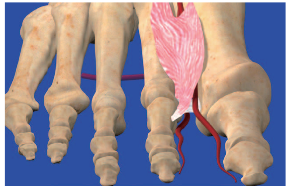 第1跖背动脉解剖与分型