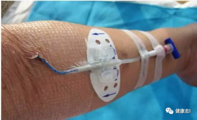 他62岁患癌，医生说只能活六个月，他却抗癌六年，最终战胜病魔