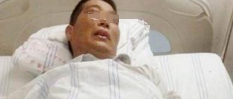 48岁男子突发脑溢血，得知事情经过，医生：饭后“最忌”2件事