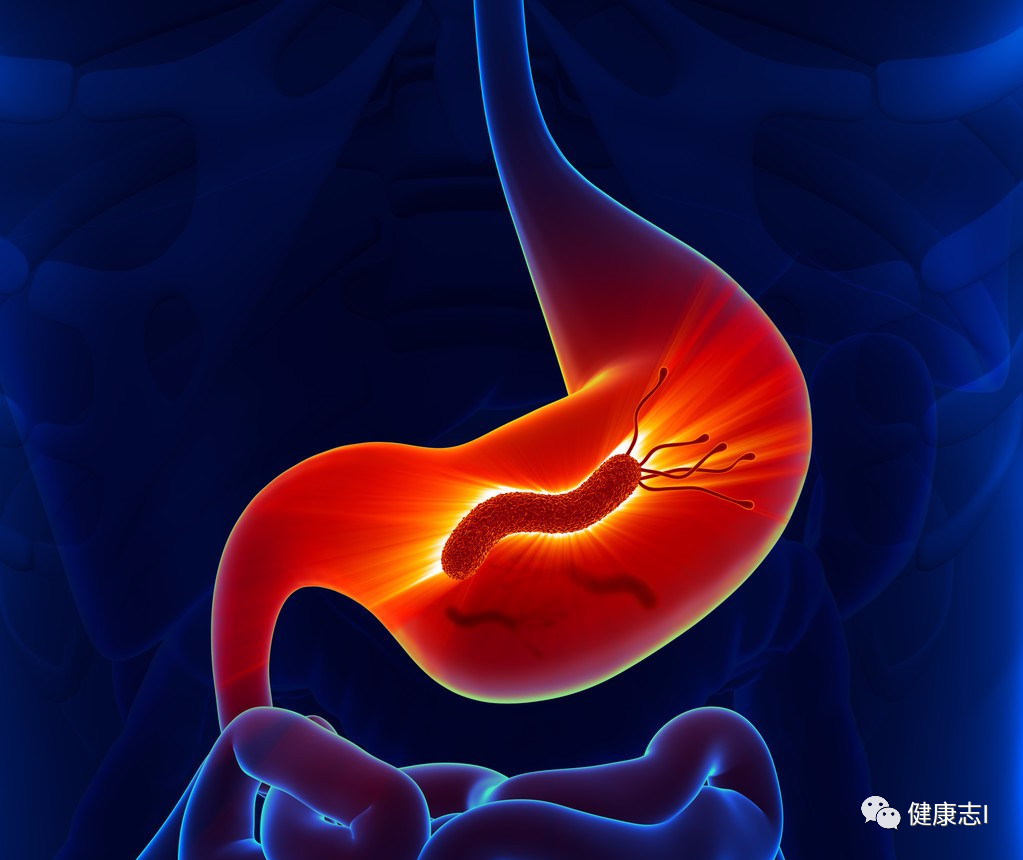 癌症虽然不会传染，但4种常见可以导致癌症的病菌却会传染