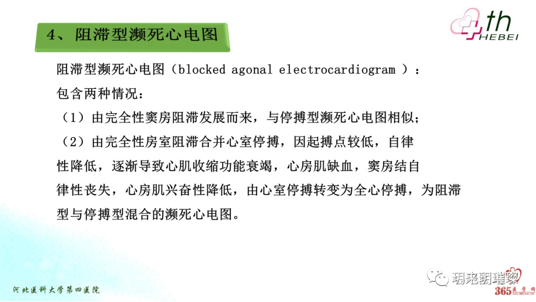 心电图如何报告死亡与濒死心电图​诊断