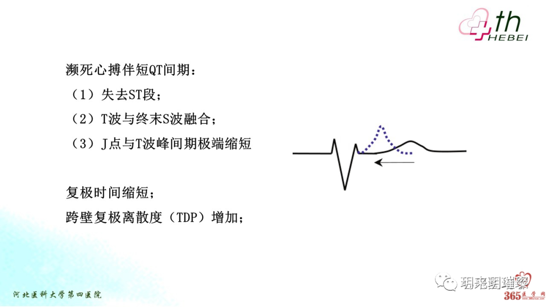 心电图如何报告死亡与濒死心电图​诊断