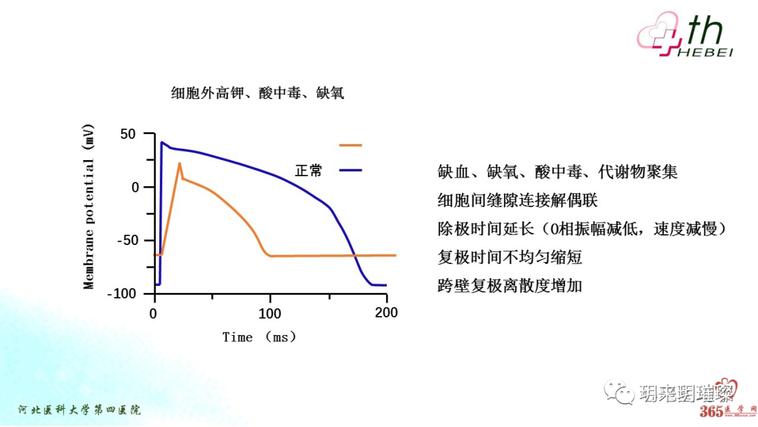 心电图如何报告死亡与濒死心电图​诊断