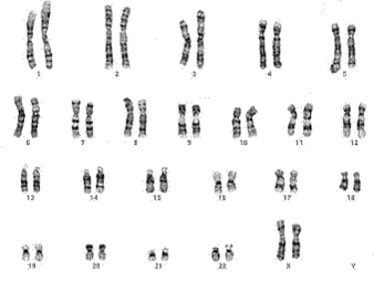 染色体及染色体常见疾病 健康教育 十堰市太和医院 国家公立三甲综合