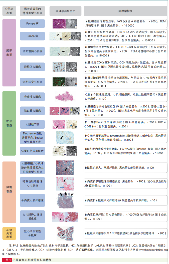 心肌病防治步入精准化、规范化、全程化管理，中国首部心肌病综合管理指南发布