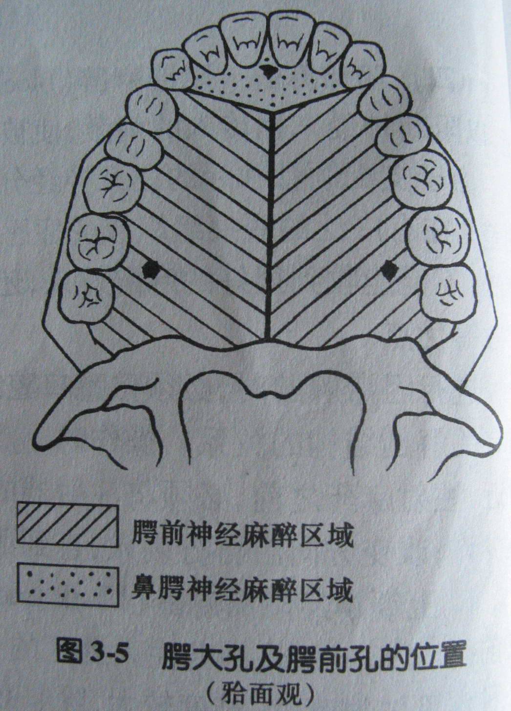 麻醉术:口腔局部麻醉