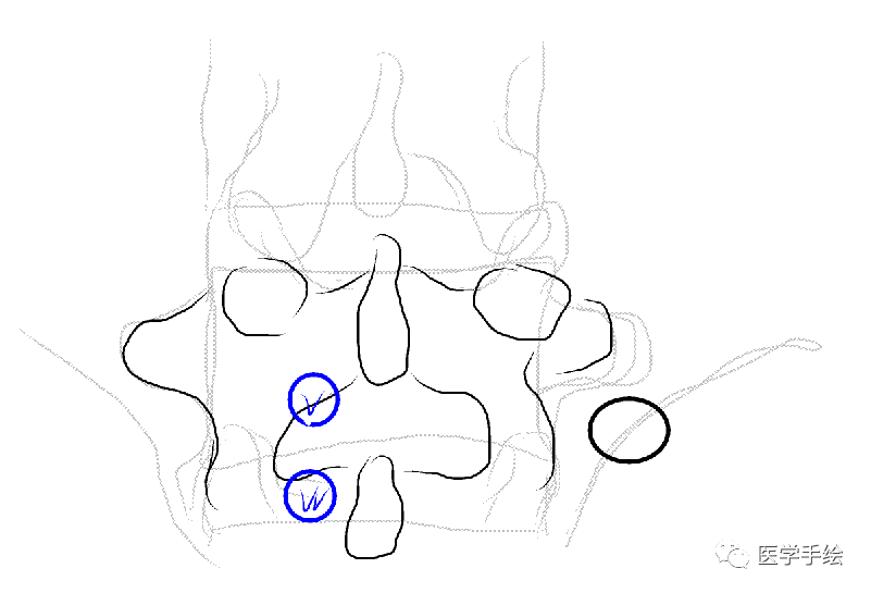 图文结合：单侧双通道内镜技术（UBE）原来没这么难！