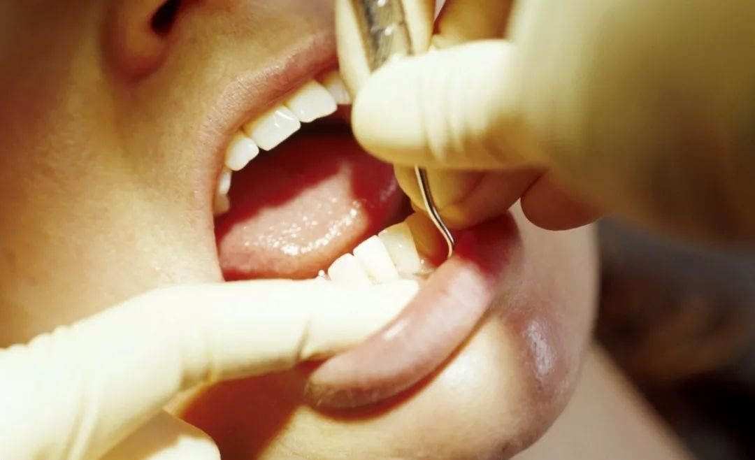 39岁男子患癌，妻子放弃治疗，医生：都怪这种食物吃的太多