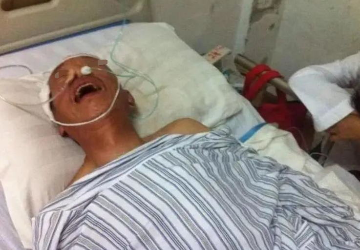 46岁中年男子突发脑梗，警告：饭后这两件事，千万别做