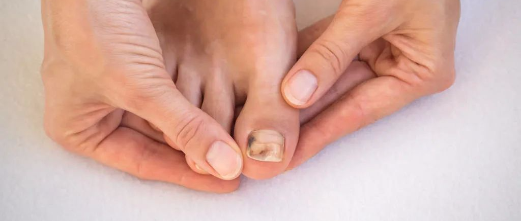 如若脚趾发生两种异常，最好去医院排查，以防癌细胞“拜访”