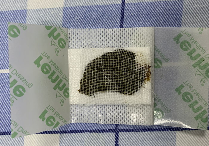 这家中医院护士的小发明，让护理工作更出彩！