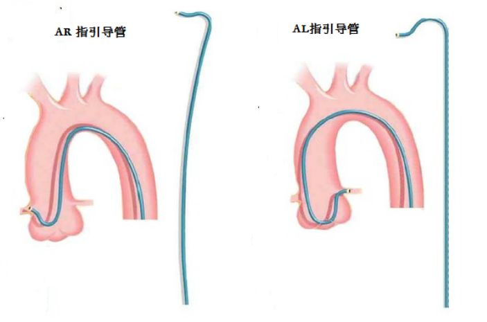 冠脉介入先利器——关于指引导管的那些事儿