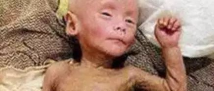 女子生出个“80岁小老头”，父母劝她丢弃，十四年后，家人欢喜