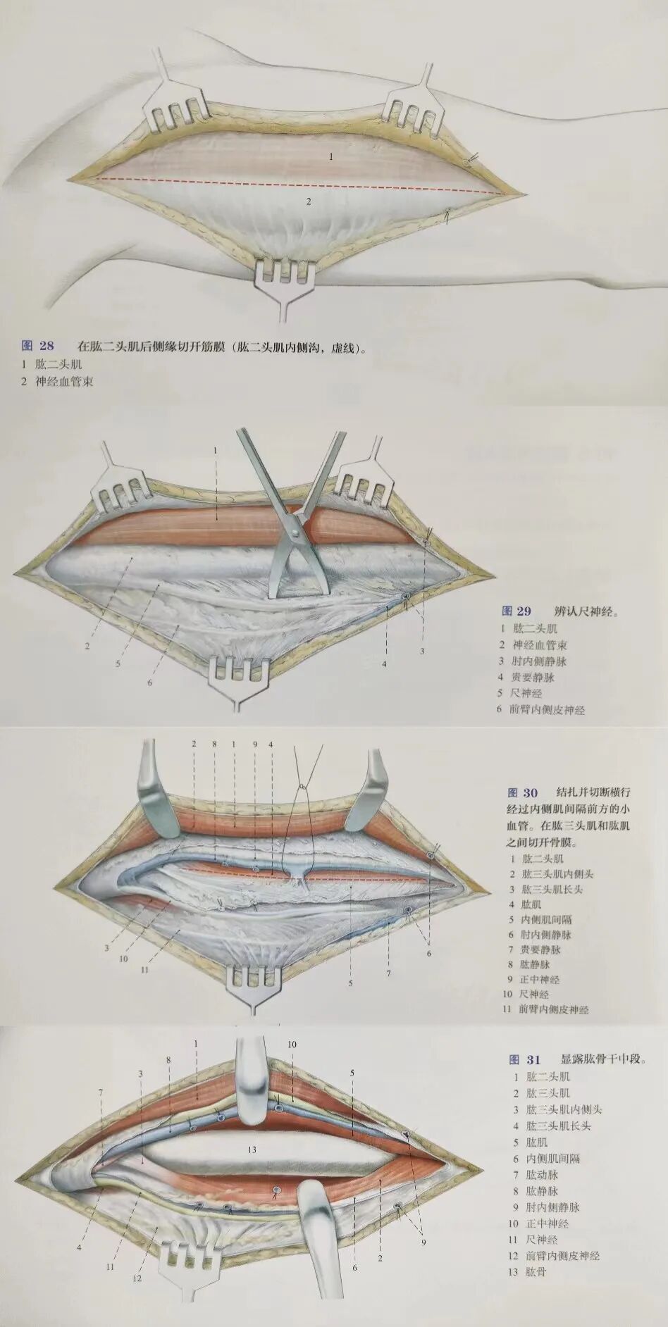 肱骨手术入路大全，赶紧收藏起来！