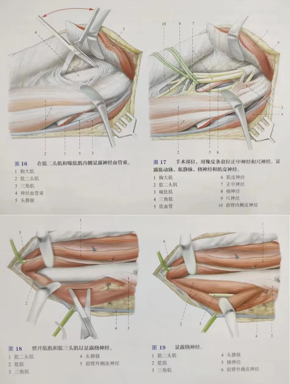 肱骨手术入路大全，赶紧收藏起来！
