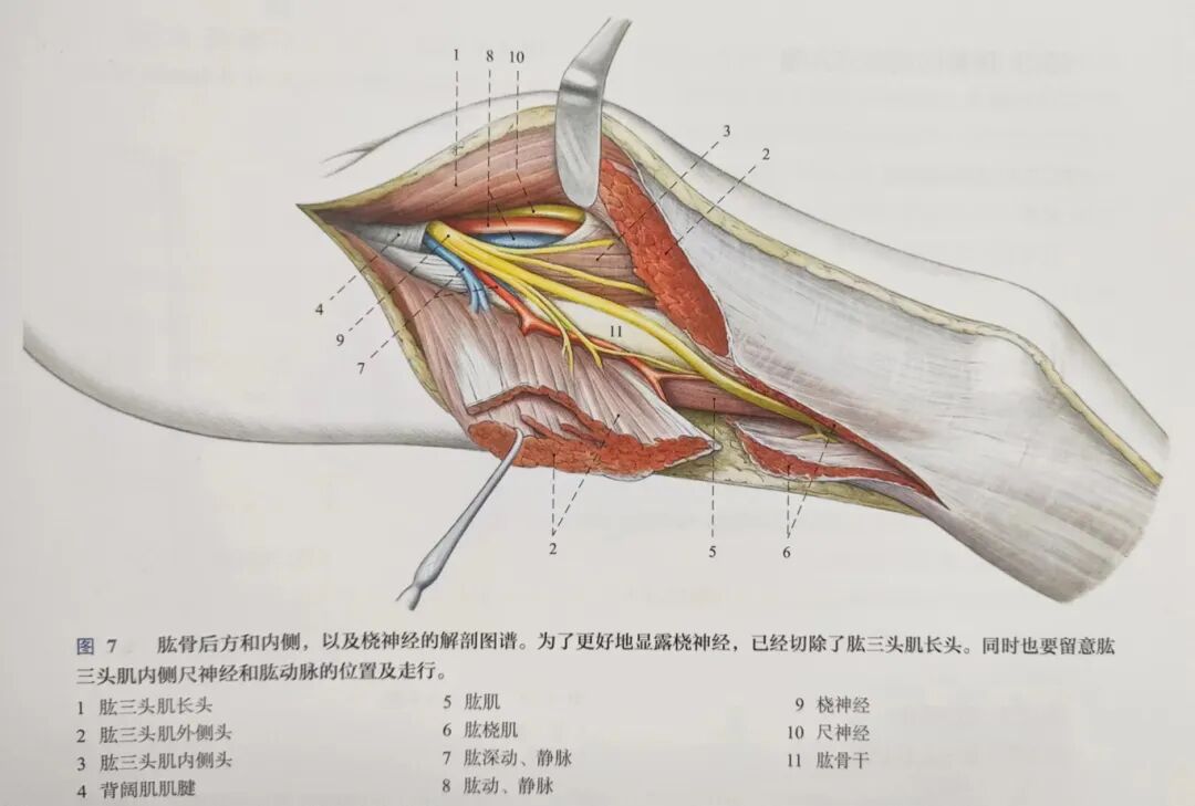 肱骨手术入路大全，赶紧收藏起来！