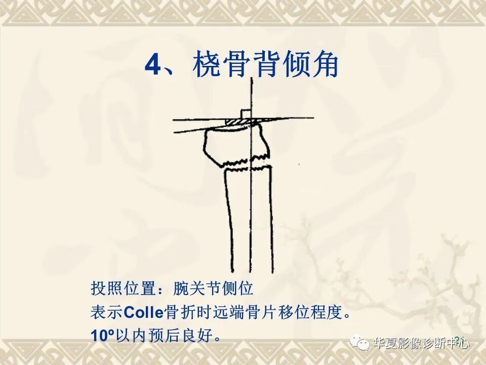 临床上常用的骨关节X线测量方法图文详解