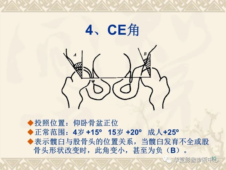 临床上常用的骨关节X线测量方法图文详解
