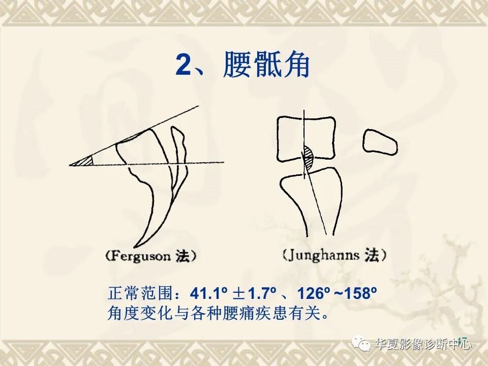 临床上常用的骨关节X线测量方法图文详解
