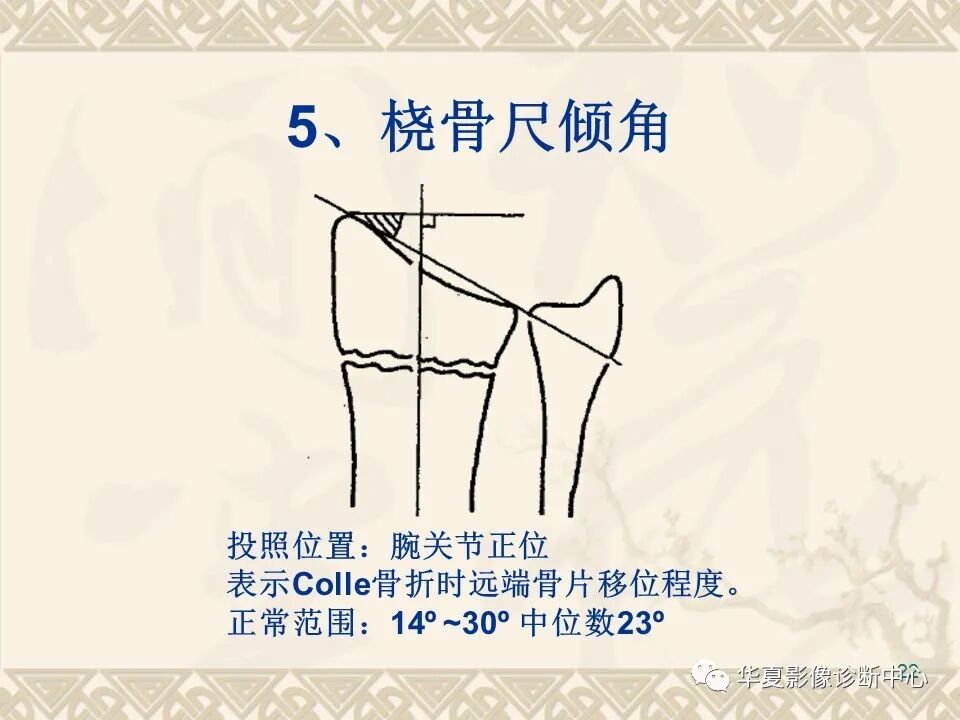 临床上常用的骨关节X线测量方法图文详解