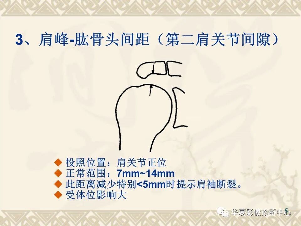 临床上常用的骨关节X线测量方法图文详解
