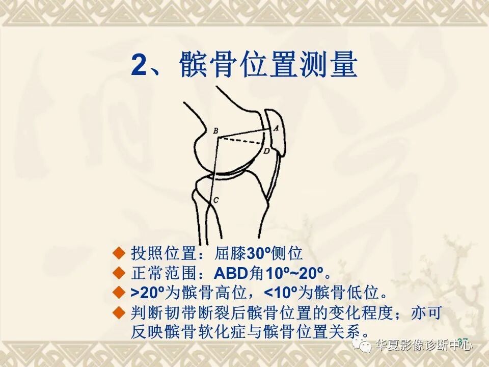 临床上常用的骨关节X线测量方法图文详解