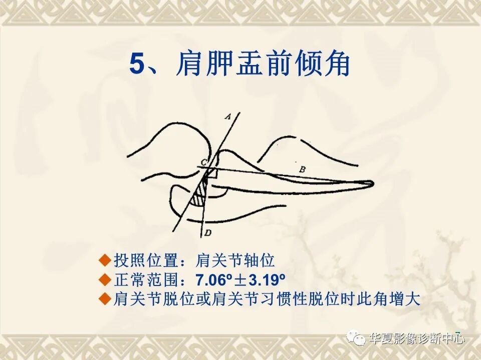 临床上常用的骨关节X线测量方法图文详解