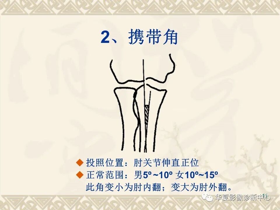 临床上常用的骨关节X线测量方法图文详解