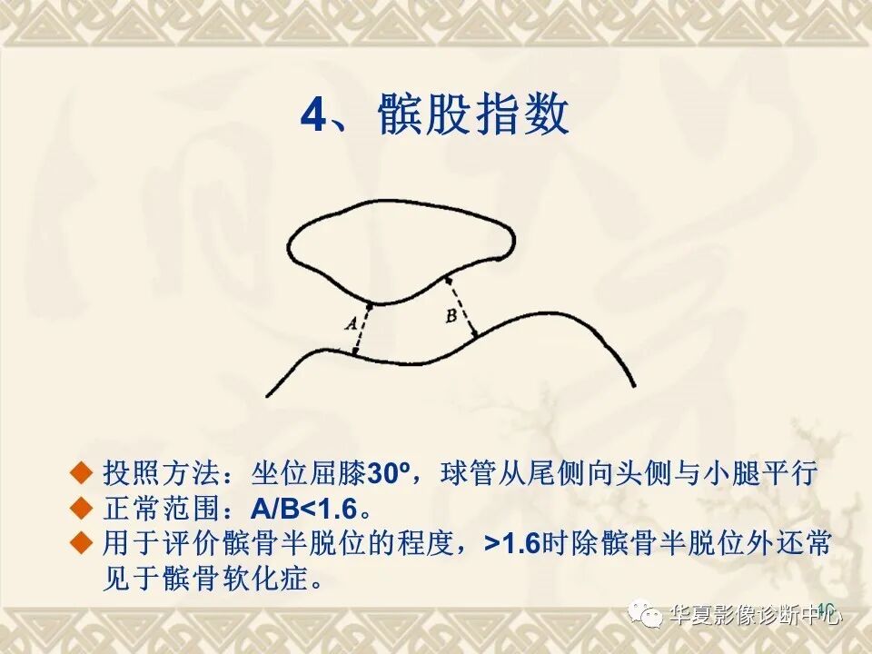 临床上常用的骨关节X线测量方法图文详解