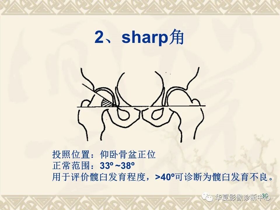 临床上常用的骨关节X线测量方法图文详解