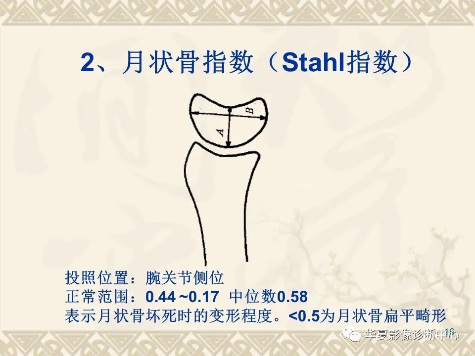 临床上常用的骨关节X线测量方法图文详解