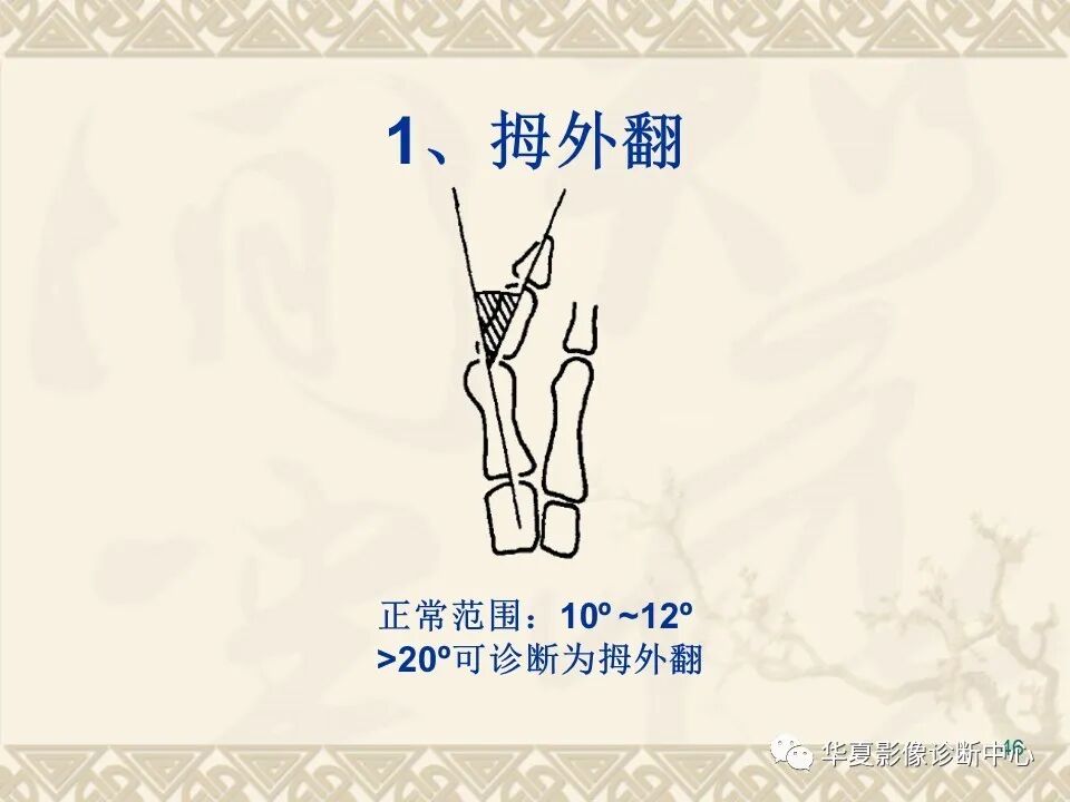 临床上常用的骨关节X线测量方法图文详解