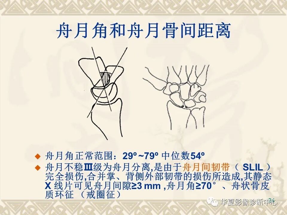 临床上常用的骨关节X线测量方法图文详解