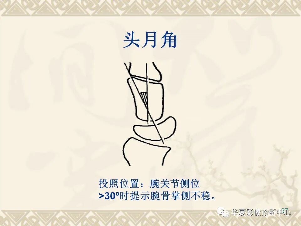 临床上常用的骨关节X线测量方法图文详解