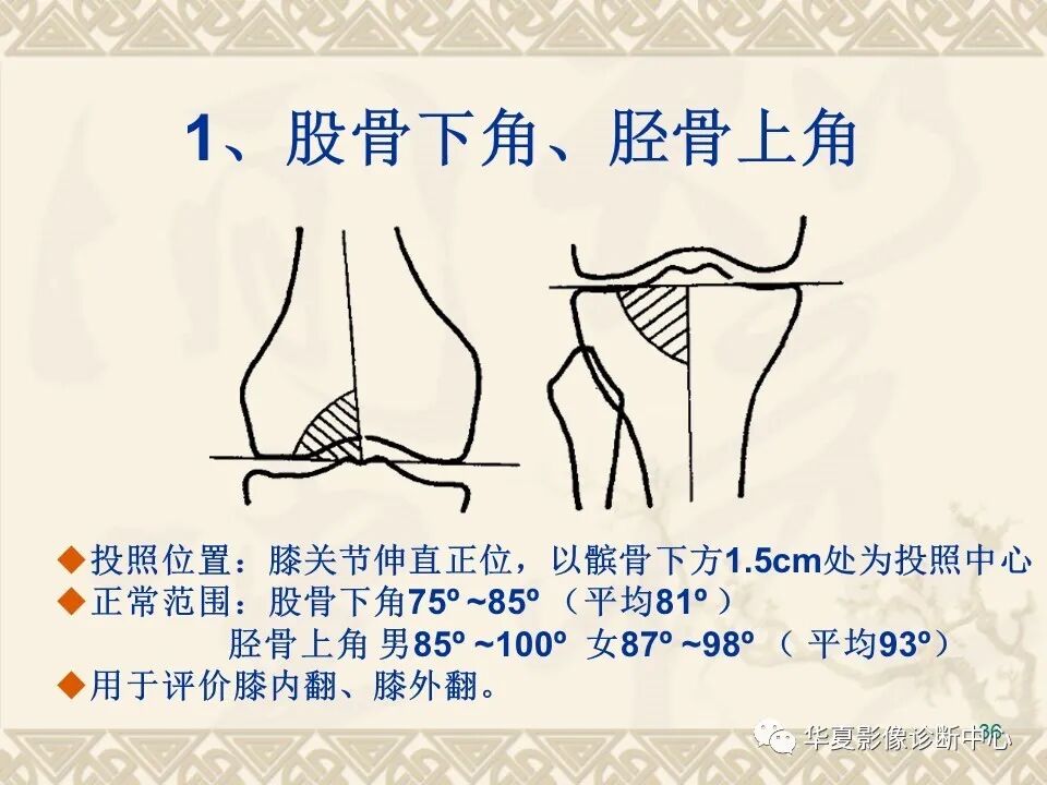临床上常用的骨关节X线测量方法图文详解