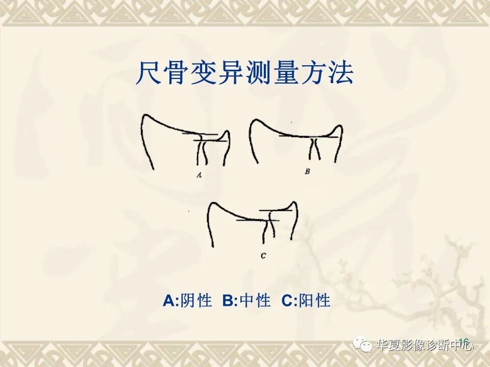 临床上常用的骨关节X线测量方法图文详解