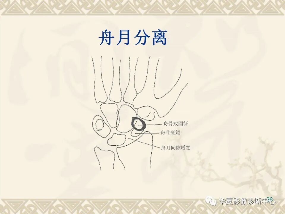 临床上常用的骨关节X线测量方法图文详解