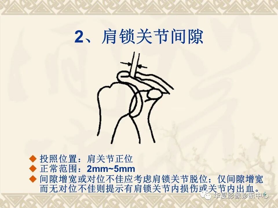 临床上常用的骨关节X线测量方法图文详解