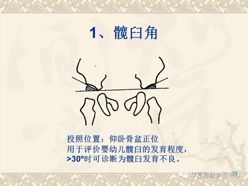 临床上常用的骨关节X线测量方法图文详解