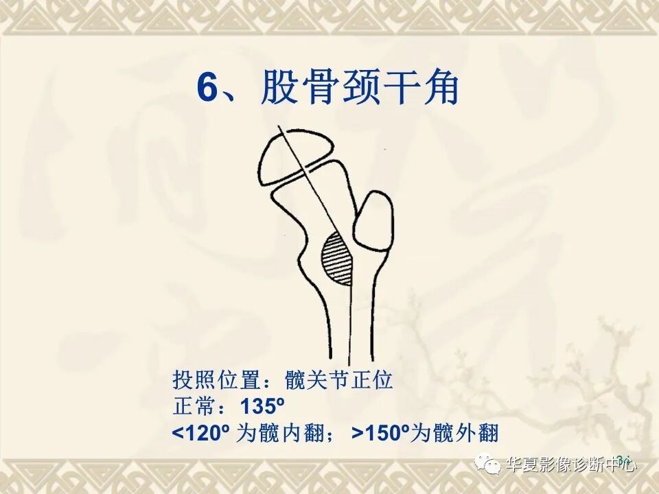 临床上常用的骨关节X线测量方法图文详解