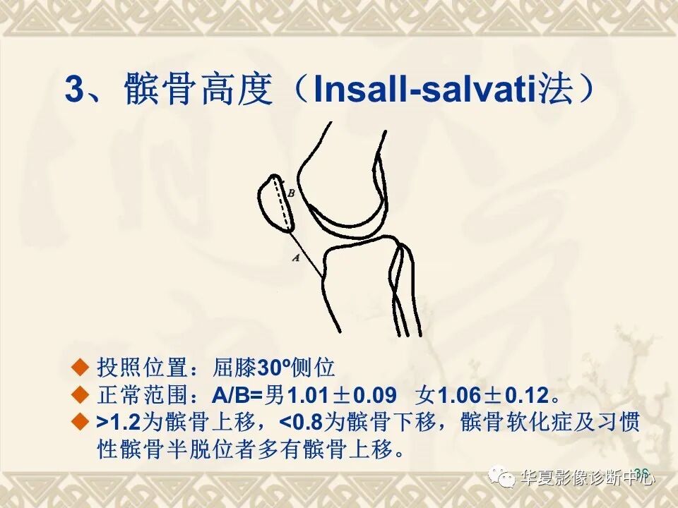 临床上常用的骨关节X线测量方法图文详解