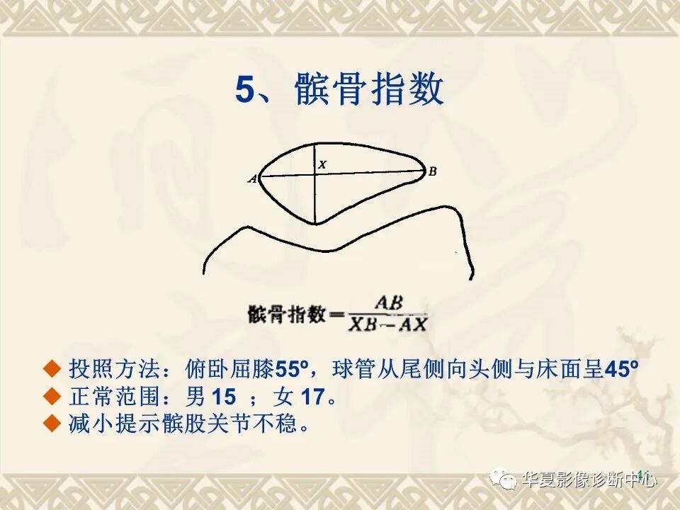 临床上常用的骨关节X线测量方法图文详解
