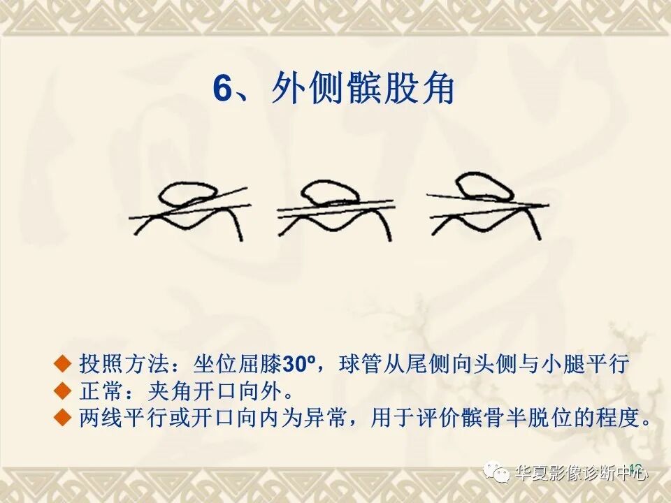 临床上常用的骨关节X线测量方法图文详解