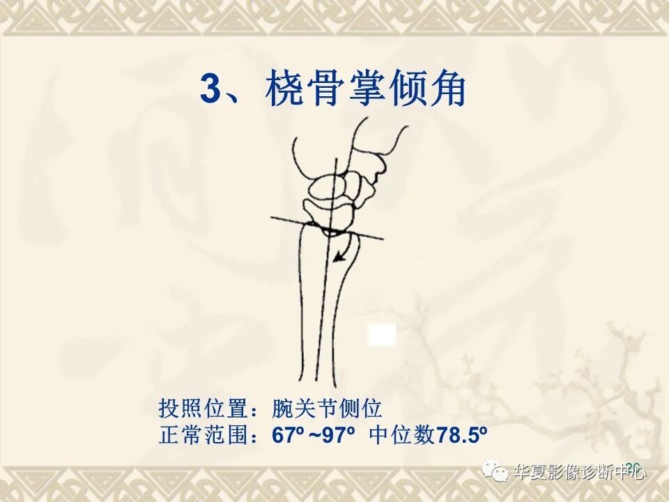 临床上常用的骨关节X线测量方法图文详解