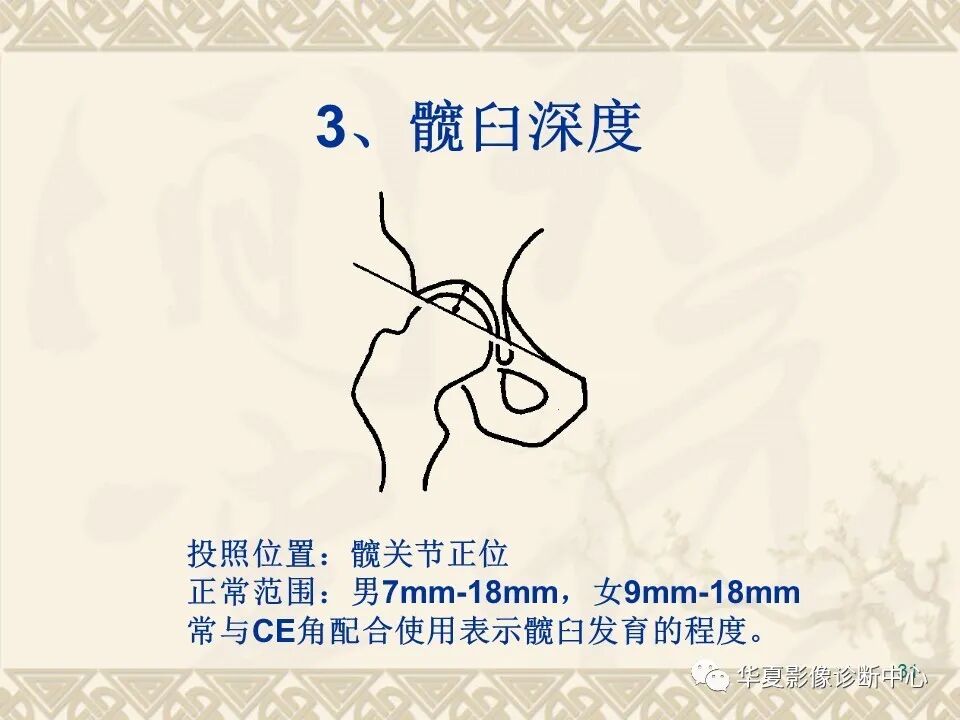 临床上常用的骨关节X线测量方法图文详解