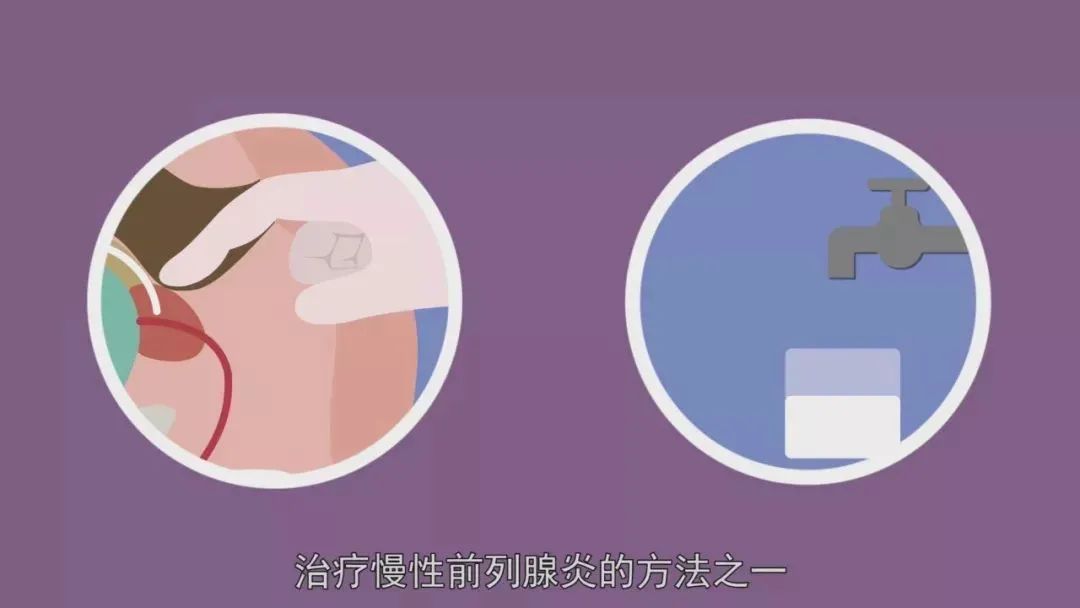 前列腺白细胞正常多少