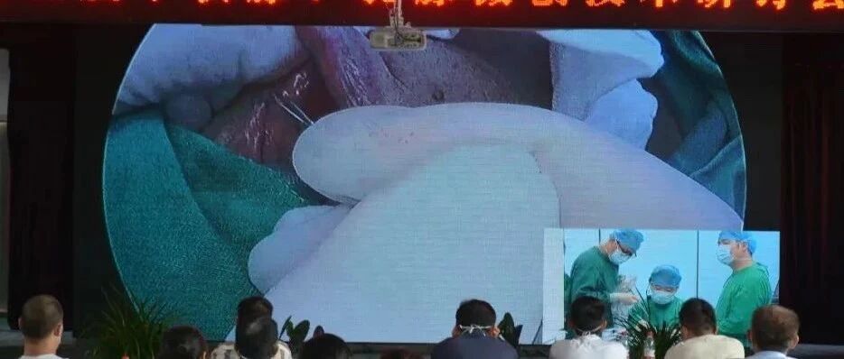 惊呆濮阳人，直击手术现场，架起生命的桥梁