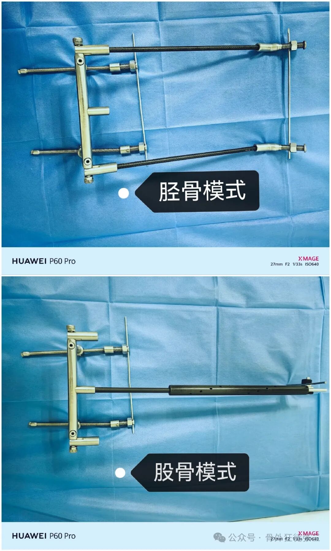 骨钩一钩定乾坤，85后高龄 ，速战速决，安全下台！